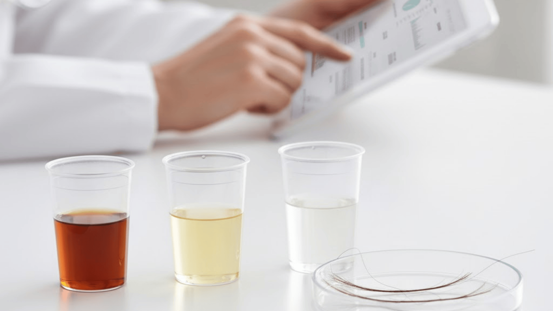 how to interpret a urine cocaine test result