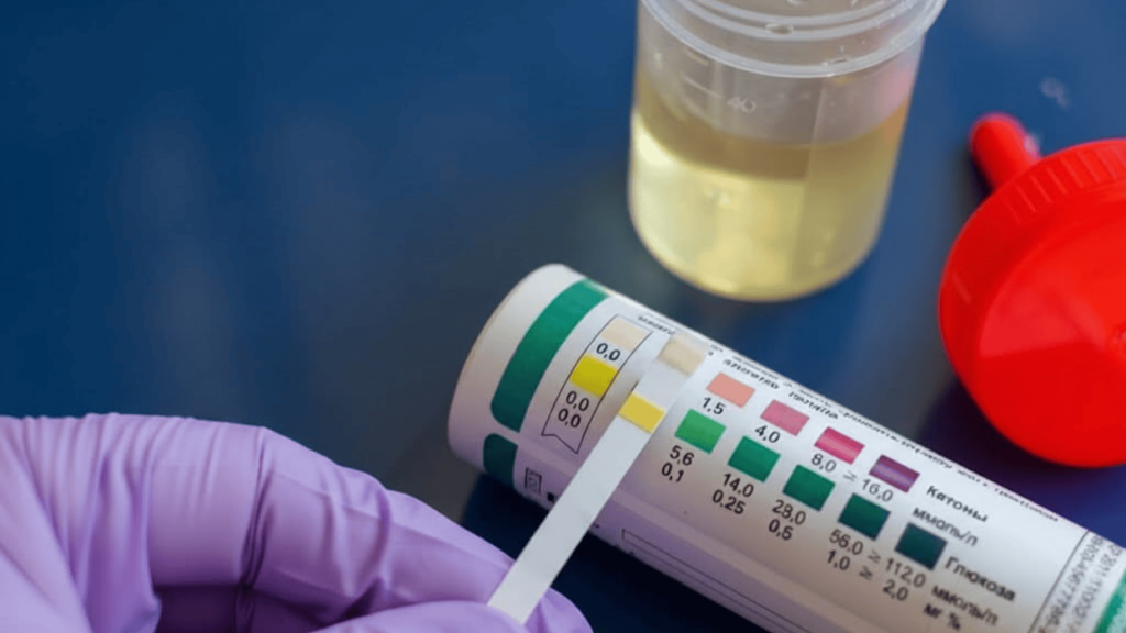 what does ket mean on a urine test a simple guide