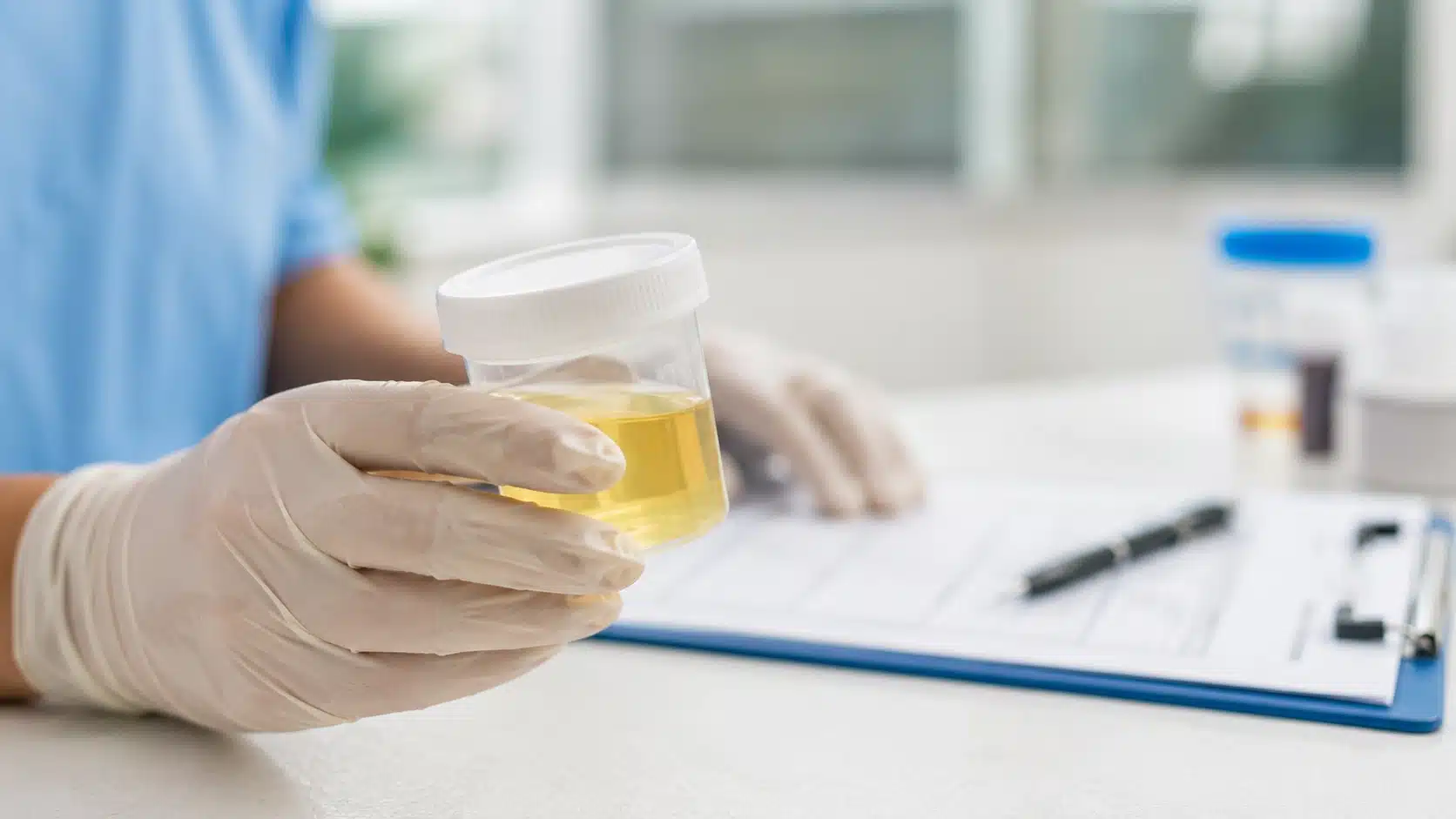 healthcare professional holding a urine specimen container during a workplace drug testing consultation