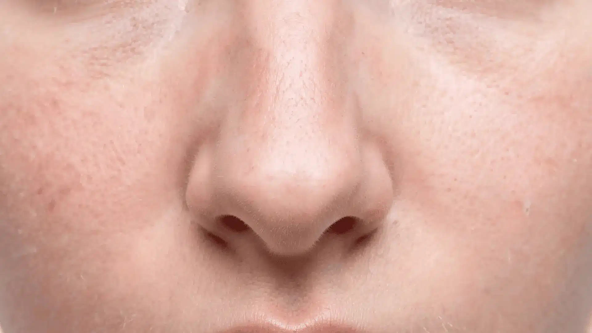 close up of a nose with reduced redness and calmer skin texture