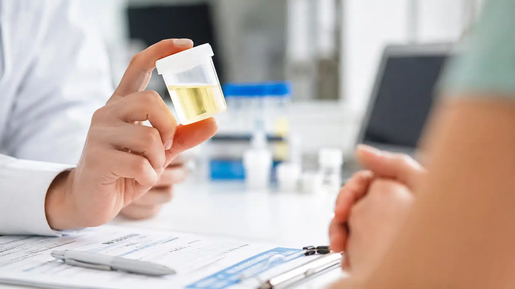 healthcare professional holding a urine specimen container during workplace drug testing consultation